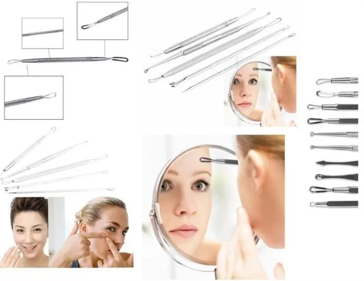 Set de 5 instrumente cosmetologice pentru curățarea pielii cu probleme.